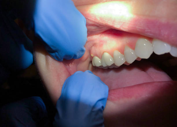 Best Urgent Tooth Repair  in Navarre Beach, FL