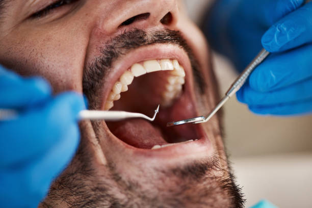 Best Knocked-Out Tooth Emergency  in Navarre Beach, FL